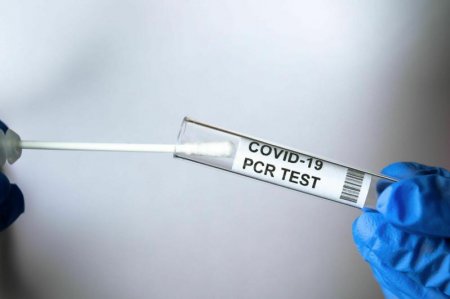 Қызылордада 36 адамнан коронавирус анықталды