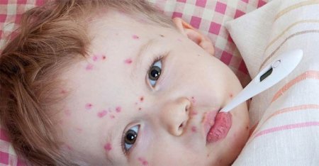 Ауру асқынса дертті