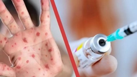 Қызылша - ауруы жайлы не білу керек?