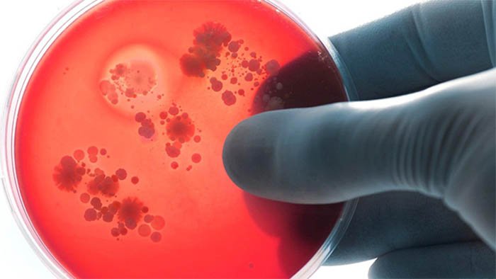 Менингококкты инфекциясы жайлы