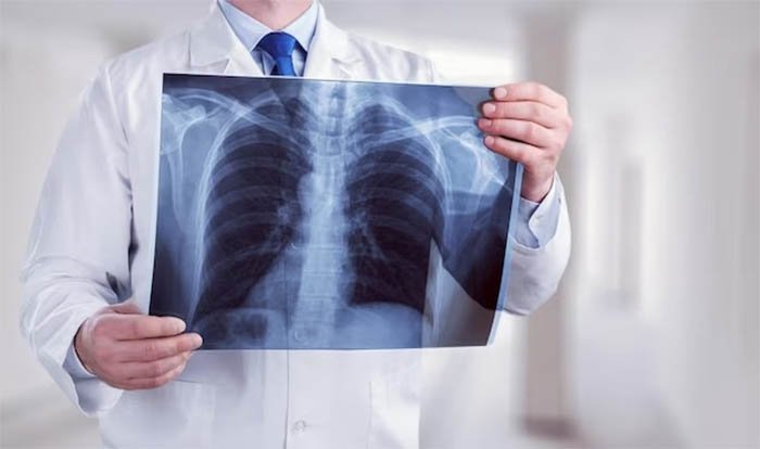 Туберкулез белгілері қалай байқалады?