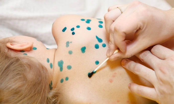 Қызылша - ауруы жайлы не білу керек?