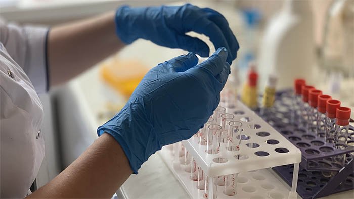 Санитариялық заңнаманы бұзу фактілерін мерзімінде анықтау және заңнамаға сәйкес шаралар қабылдау
